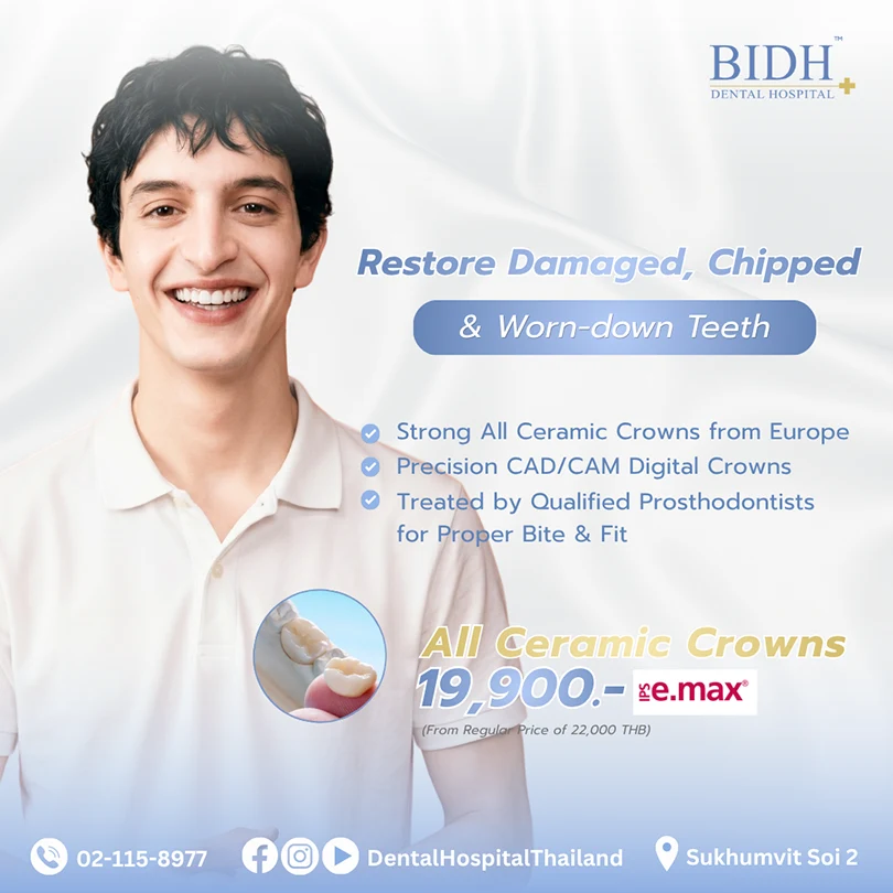 bidh dental crowns promotion